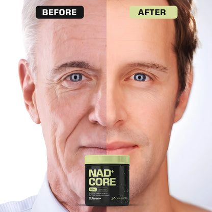 NAD+ Nicotinamide Riboside